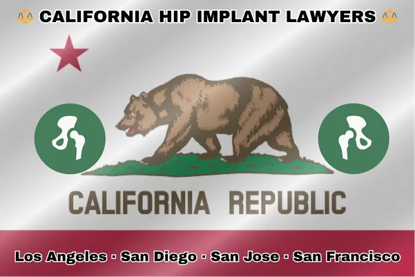 CALIFORNIA HIP IMPLANT LAWYERS: Los Angeles, San Diego, San Jose, and San Francisco text on CA state flag with hip replacement devices near a grizzly bear and red star.