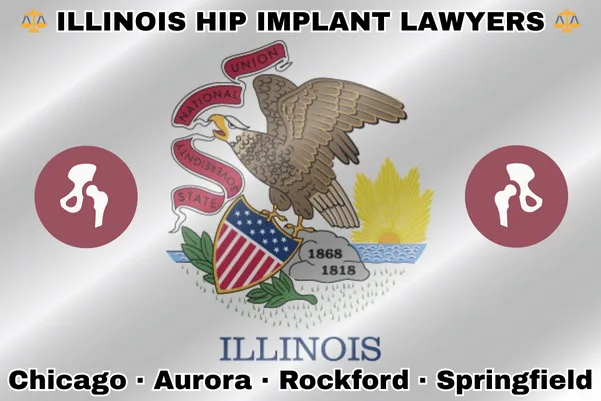 ILLINOIS HIP IMPLANT LAWYERS: Chicago, Aurora, Rockford, and Springfield text on IL state flag with hip replacement devices near a bald eagle perched on a rock and holding a shield, as the sun shines bright.