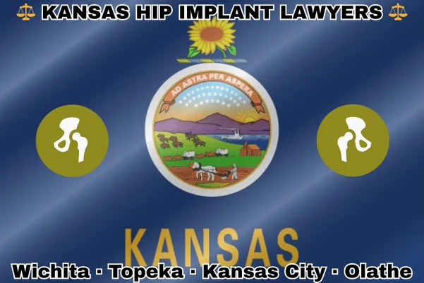 KANSAS HIP IMPLANT LAWYERS: Wichita, Topeka, Kansas City, and Olathe text on KS state flag with hip replacement devices near landscape of a rising sun, river, boat, settler’s cabin, and bison hunt, all beneath a sunflower on blue background.