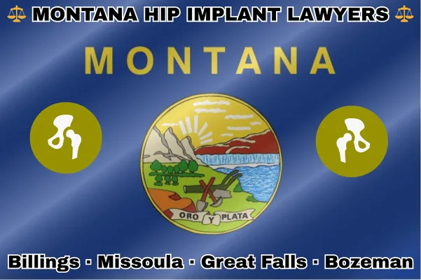MONTANA HIP IMPLANT LAWYERS: Billings, Missoula, Great Falls, and Bozeman text on MT state flag with hip replacement devices near a plow, pickaxe, and shovel on the Great Falls of the Missouri River, beside mountains, plains, and forests.