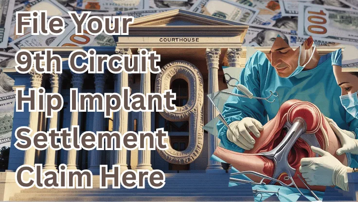 File Your 9th Circuit Hip Implant Settlement Claim Here text on depiction of Ninth Circuit court with hip replacement surgery and high value cash backdrop.